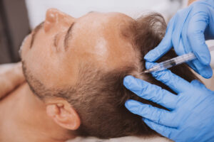 hair-clinic-frankfurt-prp